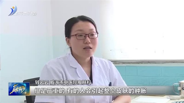 户外虫类叮咬高发 市民小心“虫咬皮炎”【威海广电讯】