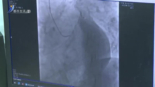 秋冬心血管病高发 如何守护健康医生有话说【威海广电讯】