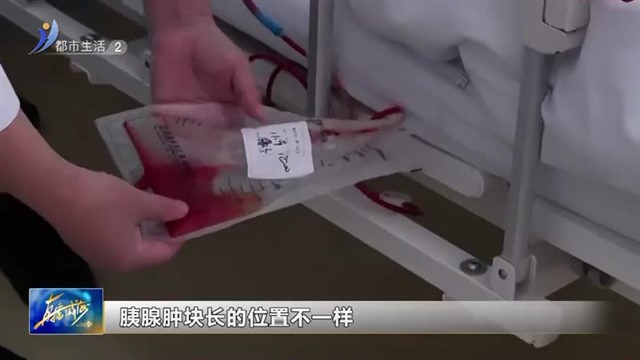 “癌症之王”胰腺癌 如何能够早发现？【威海广电讯】