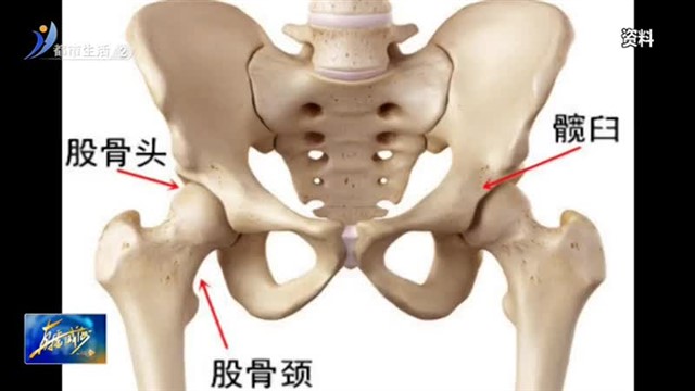 疼了二十多年 竟不知是髋部有问题【威海广电讯】