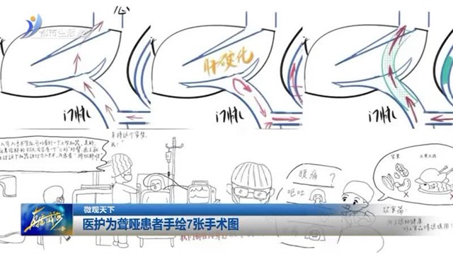 医护为聋哑患者手绘7张手术图【威海广电讯】