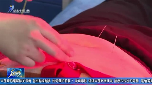 淡斑嫩肤 试试中医针灸手法【威海广电讯】