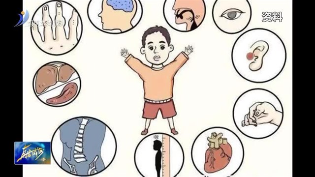 罕见并不代表“少见” 面对罕见病我们该做什么？【威海广电讯】