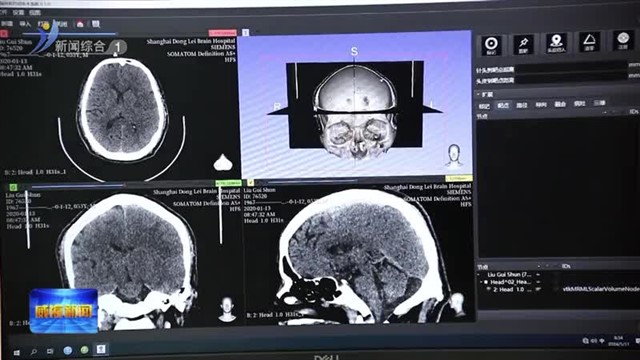 高区医航智能医疗科技中心暨少伯智能机器人项目启动【威海广电讯】