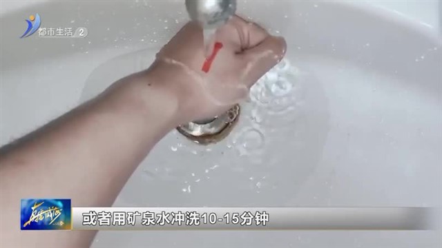 不小心烧烫伤后 该如何正确处理？【威海广电讯】