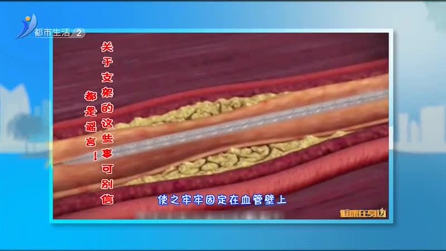 健康在身边：都是谣言！关于支架的这些事可别信【威海广电讯】