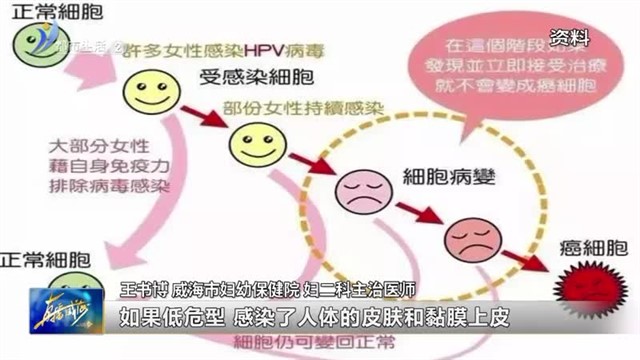 谈HPV色变？别担心，用科普打败恐惧！【威海广电讯】