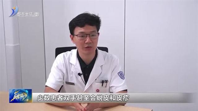 轻松“拿捏”手汗症 “尴尬癌”不再困扰社交【威海广电讯】