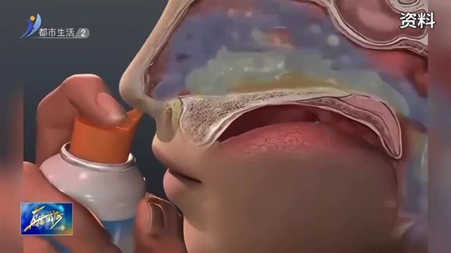 秋天到 鼻炎闹，该怎么拯救过敏性鼻炎？【威海广电讯】