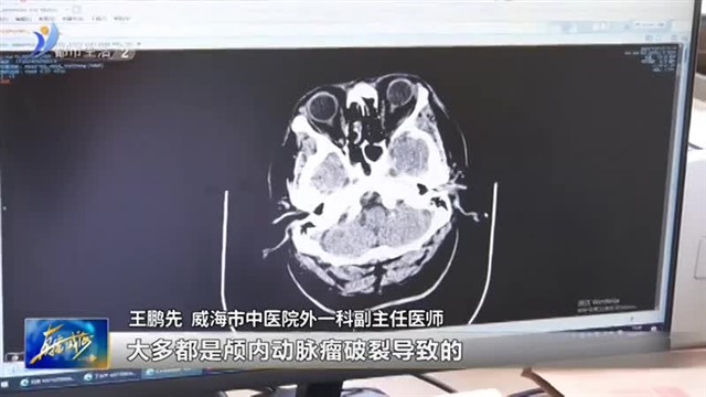 脑动脉瘤破裂三天才就诊 医生死亡线上“拉回”男子【威海广电讯】